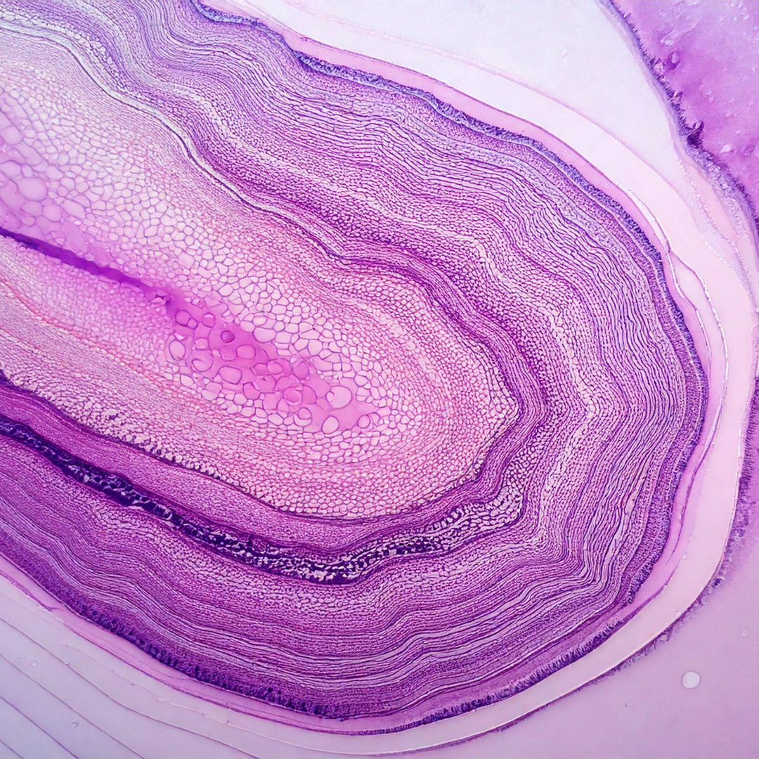 Your MVP Isn’t the Bottom Layer—It’s a Slice of the Whole Cake